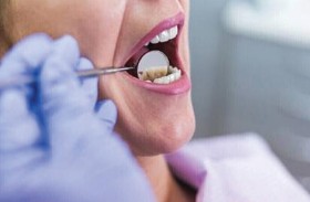ثلاث فئات من المواد الغذائية تضر بالأسنان