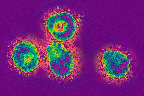 اكتشاف 12 حالة من فيروس شبيه بسارس في العالم 