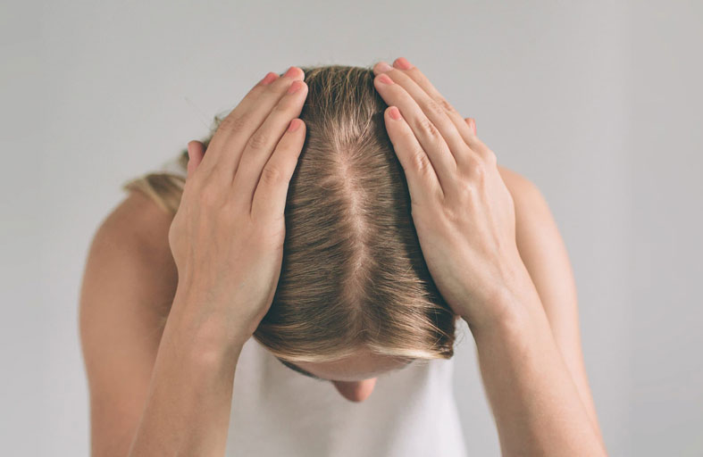  علاج غير جراحي لتساقط الشعر يلقى رواجا متزايدا