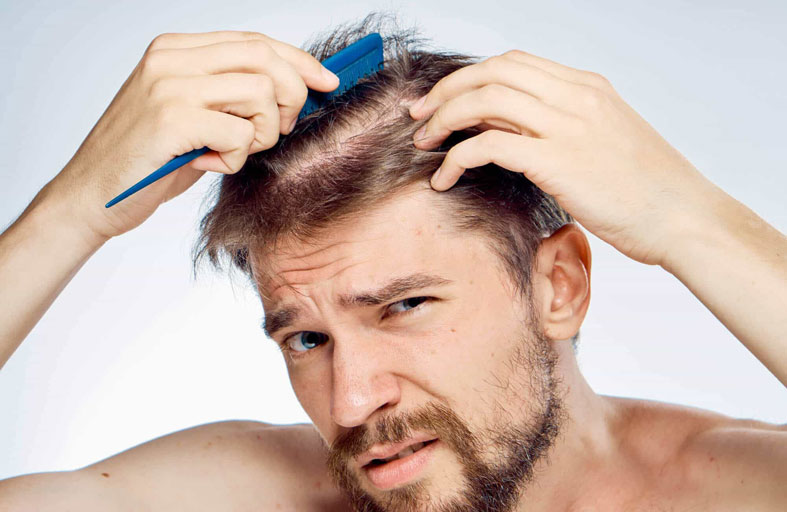 5 أسباب قد تؤدي إلى تساقط الشعر 