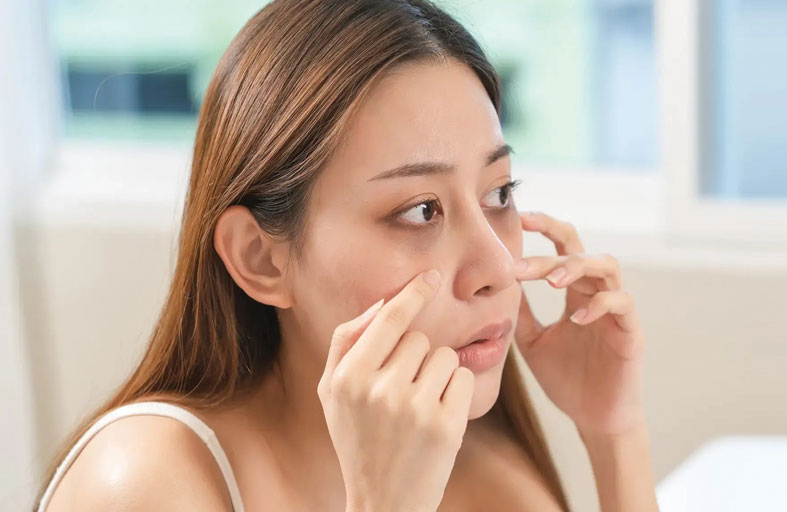 ليست بسبب السهر فقط.. ألوان الهالات تحت العينين تكشف أمراضا داخلية