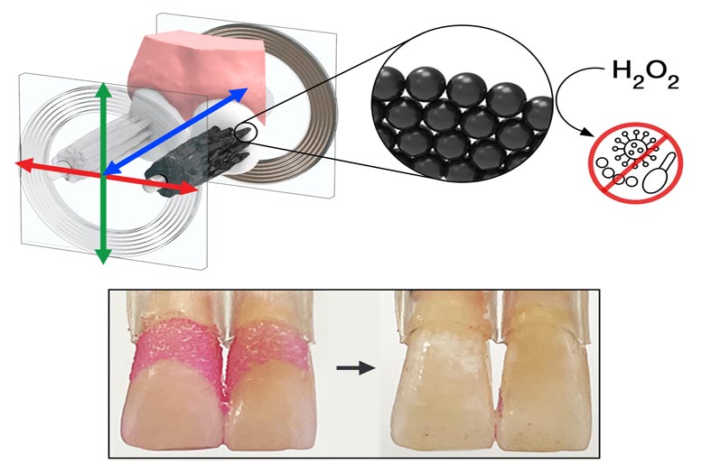 باحثون يبتكرون روبوتات صغيرة يمكنها تنظيف أسنانك تلقائيًا