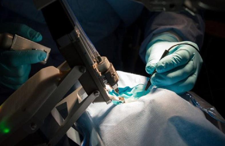 أطباء يُخرجون طرف قلم من عين طفل