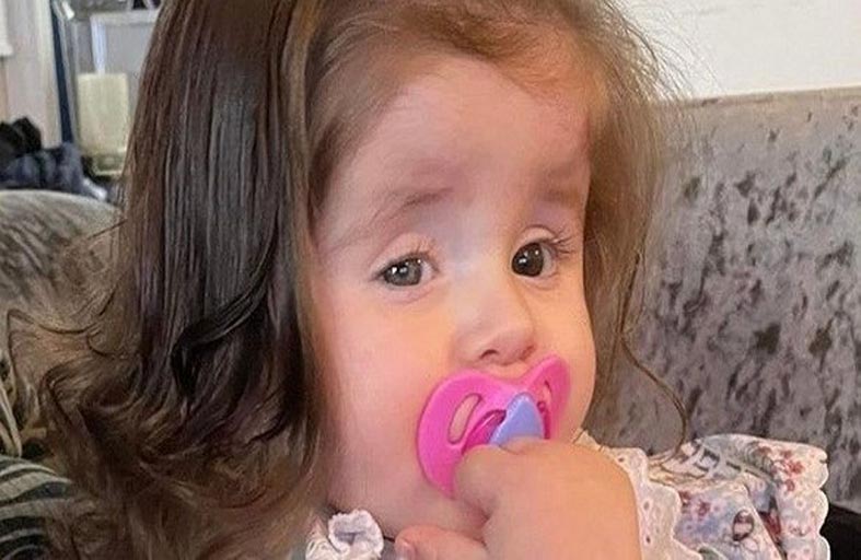 طفلة تأكل خصلات شعرها 