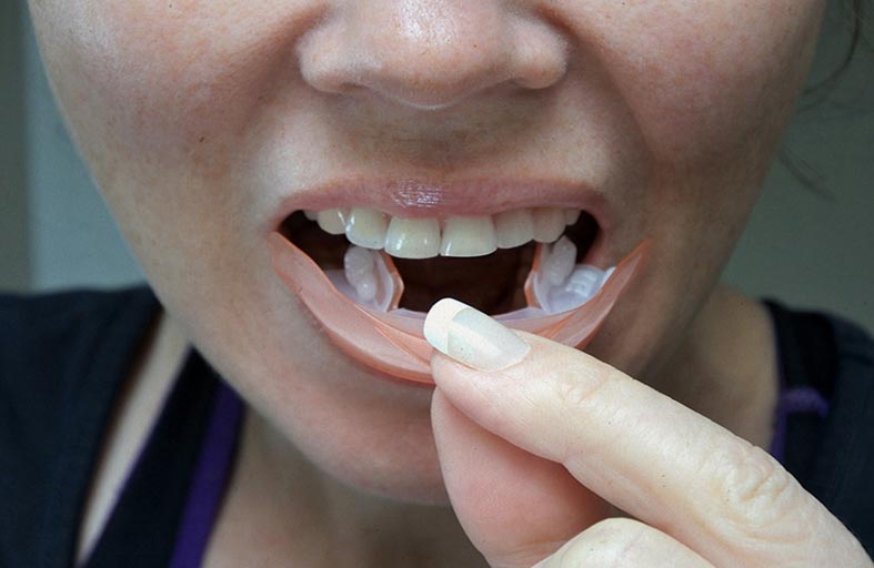 أساليب متداولة قد يكون لها تأثير مدمر على صحة فمك
