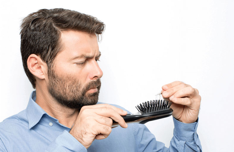 تساقط الشعر أحد الأعراض الهامة للإصابة بـ كوفيد - 19!