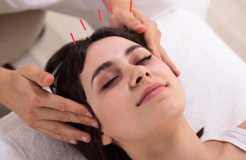 الوخز بالإبر مرتين أسبوعيا.. يساعد في علاج الاكتئاب