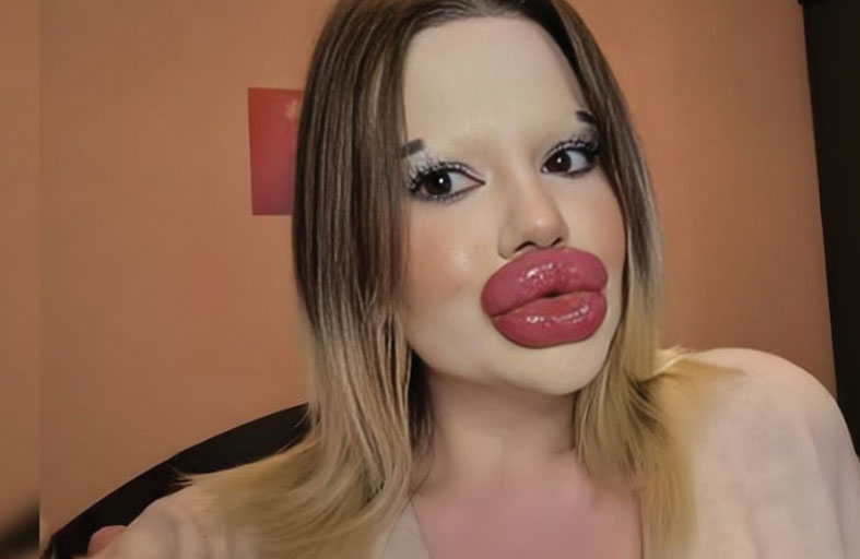 رد ناري من صاحبة «أكبر شفاه في العالم» على الساخرين!