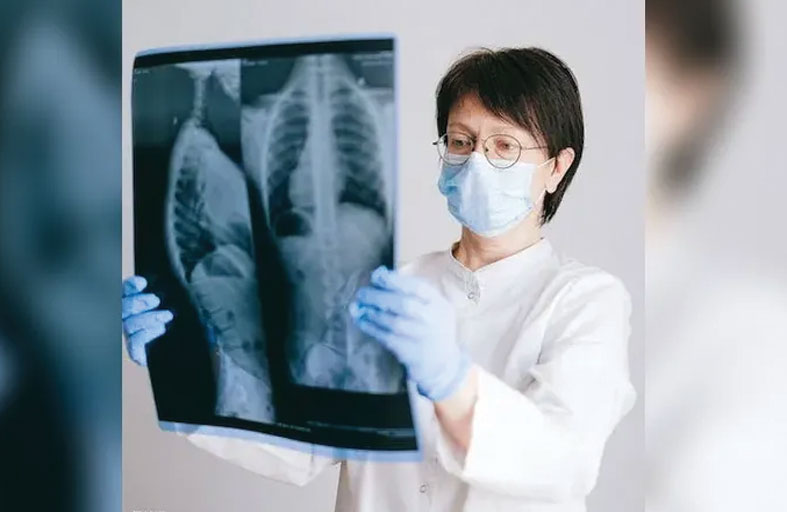 نتائج إيجابية لتجارب سريرية على لقاح علاجي لسرطان الرئة