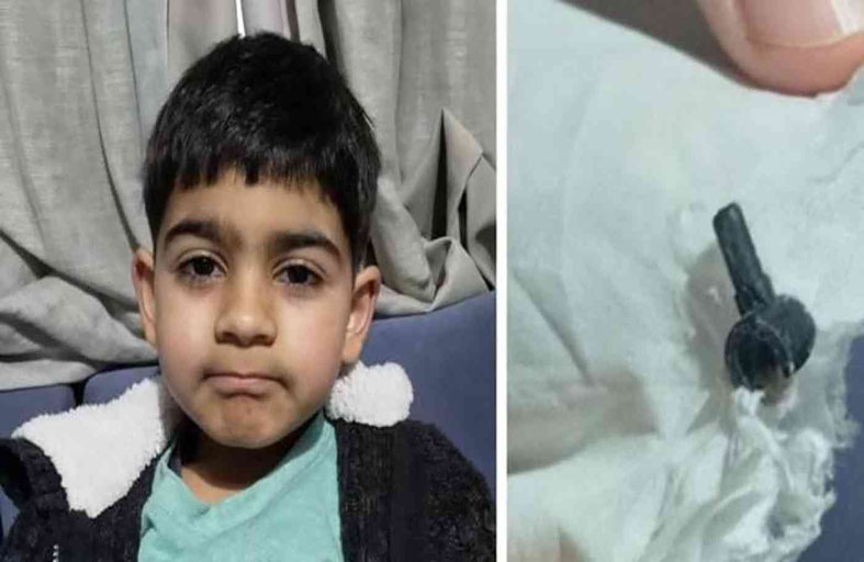 العثور على قطعة ليغو داخل أنف طفل