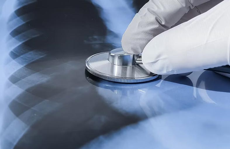 عقار جديد يعالج الدرن في شهرين فقط