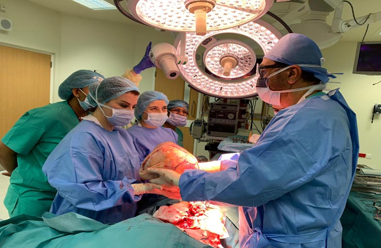 أطباء مستشفى الجامعة بالشارقة ينجحون باستئصال ورم ليفي يزن 6 كيلوجرام من رحم مريضة بعمر 28 عاماً