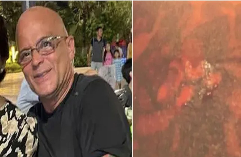 وفاة رجل مسن مختنقاً بعدما تناول أخطبوطاً حياً