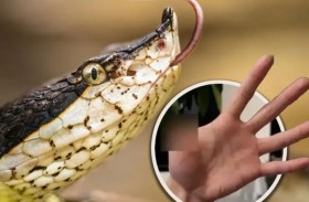 رجل يفقد إصبعه بعضة ثعبان