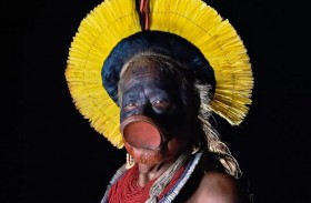 زعيم قبائل الأمازون راوني في المستشفى 