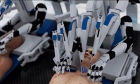 أول نظام لزراعة الرأس في العالم