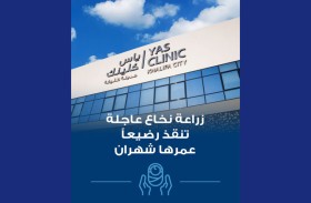 «ياس كلينك» تنقذ حياة طفلة من خلال عملية زراعة نخاع عظم إسعافية