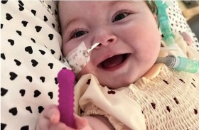 تولد مصابة بحالة تتسبب بتفكك عظامها داخل جسمها