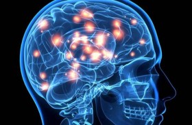 الذكاء الاصطناعي يقلص تبعات الجلطات الدماغية