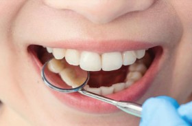 المكون الذي يحسم المعركة ضد تسوس الأسنان