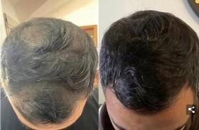 يربح 25 ألف دولار خلال ساعات بفضل بيع شامبو 