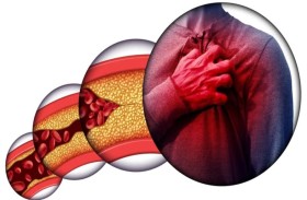 كيف نواجه المخاطر الصحية للكوليسترول الضار؟ 