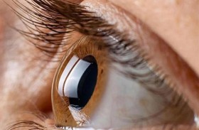 عوائم العين.. تعرف إلى سبب وعلاج الأشكال الغريبة