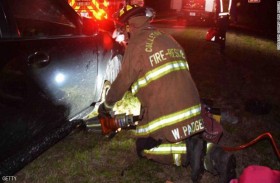 تنقذ حياتها بـأصابع قدميها