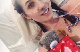 عملية رائدة تستنزف دماء امرأة لعلاج جلطات قاتلة