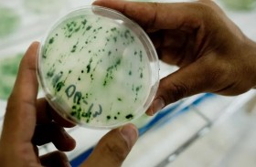 أفضل من اللحوم.. سبيرولينا الغذاء الخارق صديق البيئة