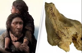 اكتشاف أول حالة «متلازمة داون» في العالم