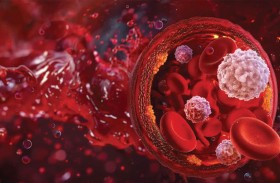 علامة غير متوقعة قد تكشف السرطان مبكراً