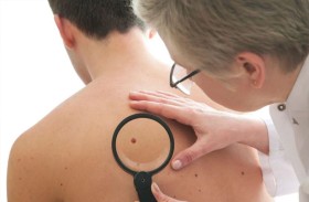 الزوائد الجلدية.. إشارة تحذيرية مبكرة لمقاومة الأنسولين