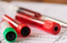 علاج جيني حديث لمرض الثلاسيميا بيتا