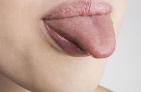 مؤشر على اللسان يدل على زيادة سكر الدم