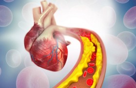 علامة تحذير من ارتفاع نسبة الكوليسترول قد تظهر 