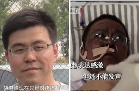 طبيب يستعيد لون بشرته بسبب كورونا