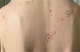 طبيب يدون ملاحظاته على جسم مريضه