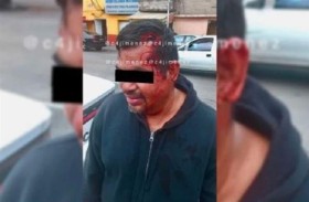 الرصاص يرتد من جمجمة رجل 
