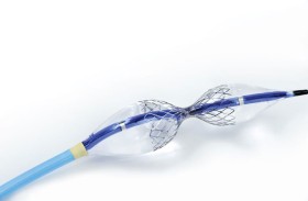 «كليفلاند كلينك أبوظبي» يجري أول عملية لزرع جهاز يُخفّف آلام الذبحة الصدرية