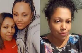 جراحة تجميل تقتل بريطانية في تركيا