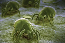 هل تنتبه إلى حساسية عث الغبار المنزلي؟