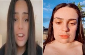 جراحة تجميلية  تحول وجهها  إلى مربع الشكل