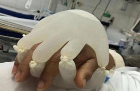 ممرضة تدعم مرضى كورونا بفكرة رائعة