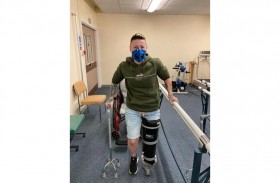 تفقد ساقها بسبب جرح بسيط قبل 17 عاماً