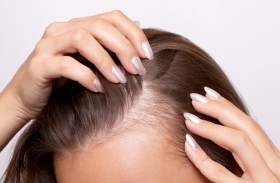 علاج فعّال لتساقط الشعر يحقق نتائج ملحوظة خلال شهرين فقط