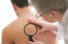 تطوير حقنة جسيمات نانوية محملة بالأدوية لعلاج سرطان الجلد