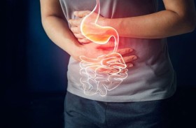 كيف تواجه حرقة المعدة وارتجاع المريء أثناء الصيام؟