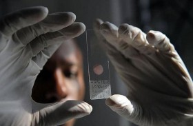 كلوروكين.. تطور جديد للدواء المحير