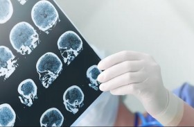 ارتباط غريب بين الباركنسون والمنتجات قليلة الدسم